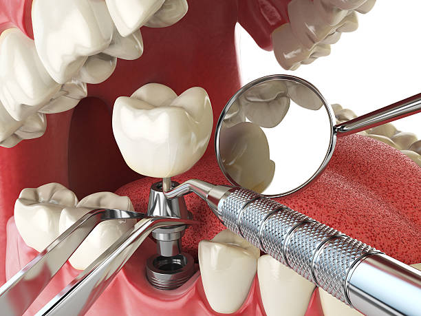 Best Broken or Cracked Tooth Emergency Dentist in Heidelberg, PA